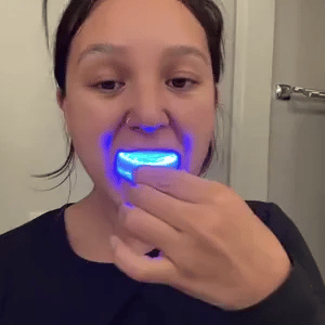 Dentilux PRO — Blanquea Tus Dientes 5 Tonos Más en Solo 20 Minutos Desde Casa ✨