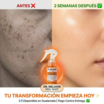 Dr. Melaxin Peel Shot — Elimina Manchas, Afina la Piel y Recupera Tu Brillo Natural en Días ✨
