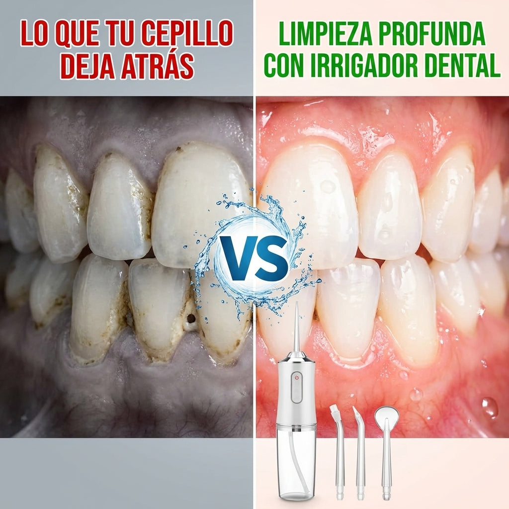 Irrigador Dental Inalámbrico — Elimina Lo Que Tu Cepillo No Puede En Segundos 💧