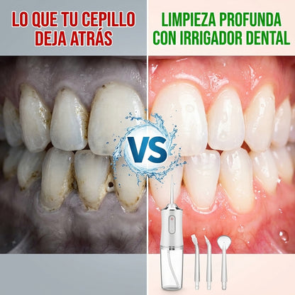 Irrigador Dental Inalámbrico — Elimina Lo Que Tu Cepillo No Puede En Segundos 💧
